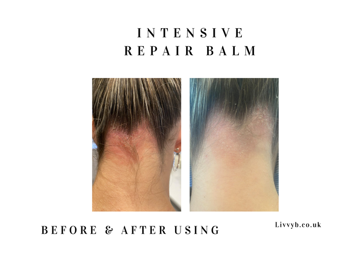 Before and after comparison images showing the back of a person&