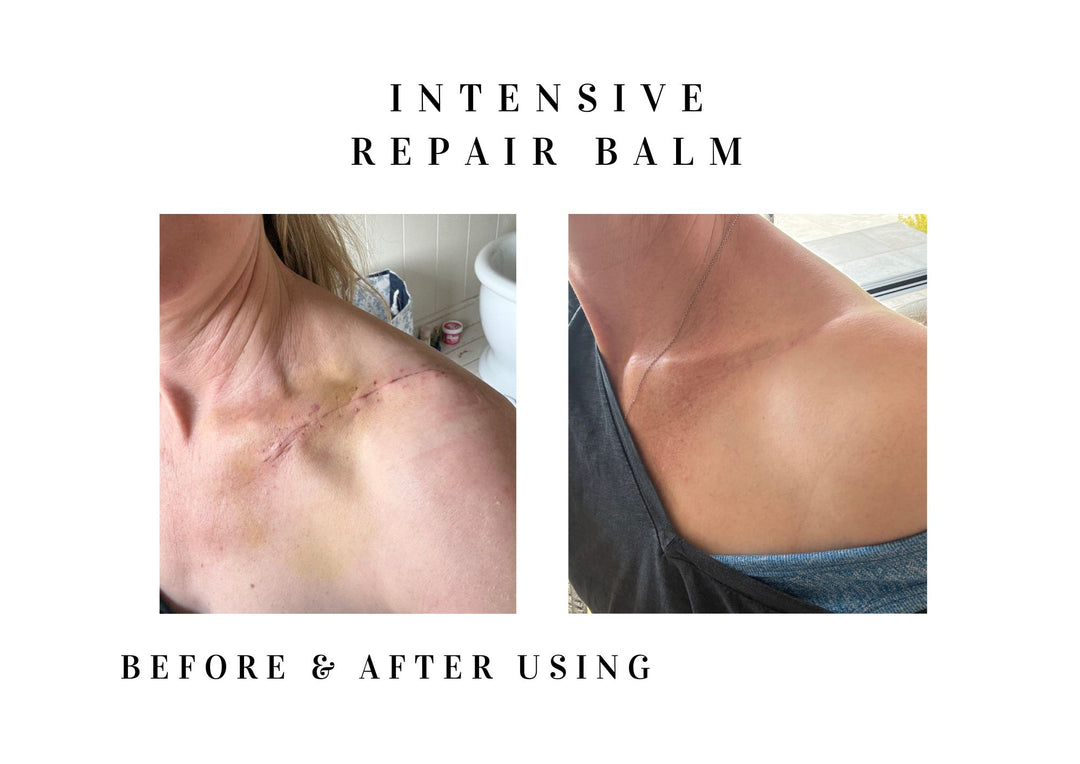 A before-and-after comparison graphic for &